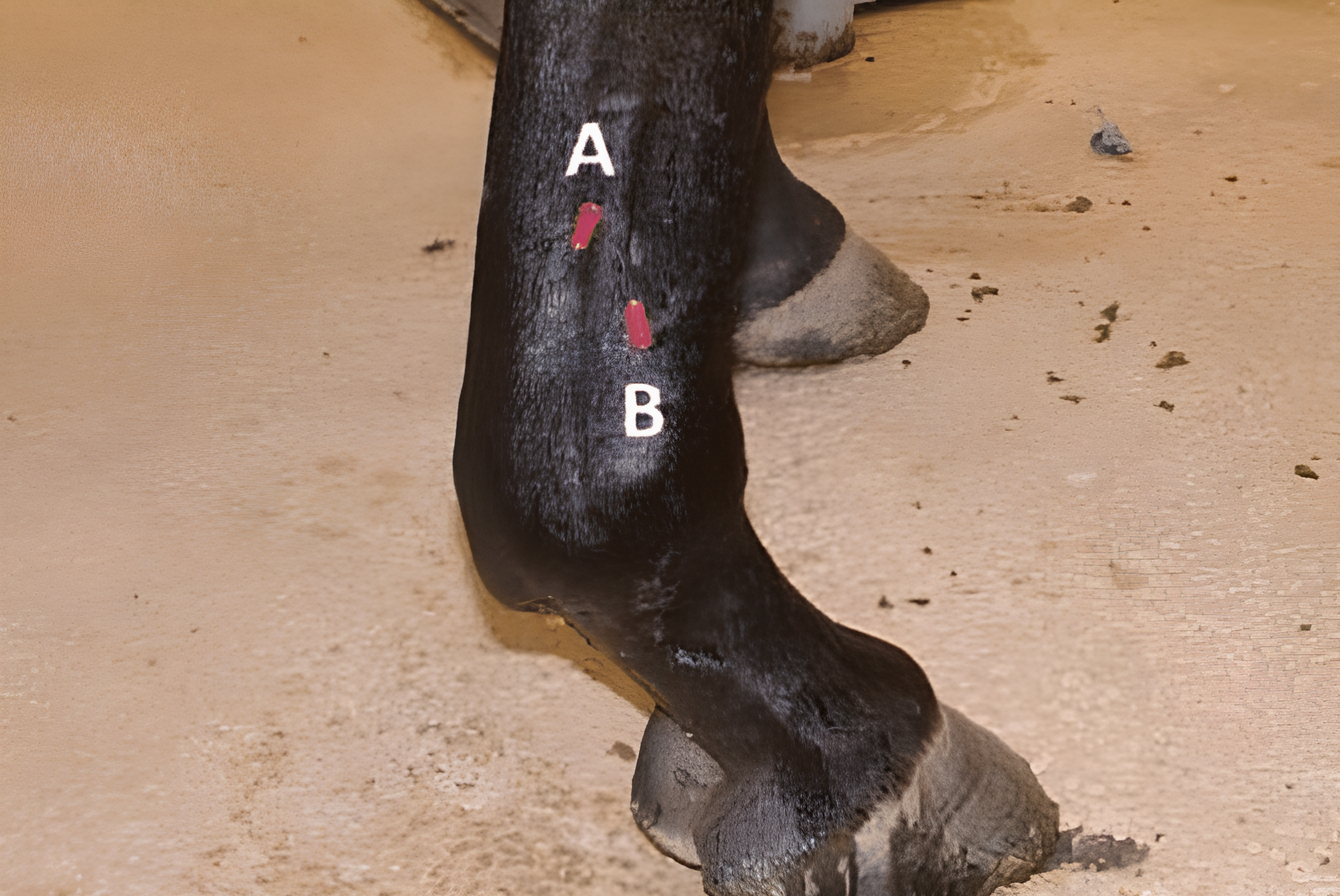 Bloqueio Perineural 4 Ponto Baixos - Local e para o que serve?