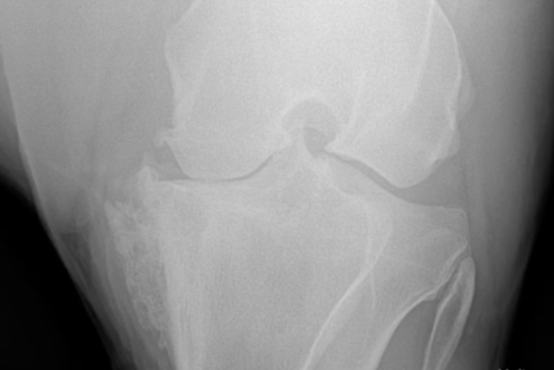 Osteoartrite em Cavalos de Competição