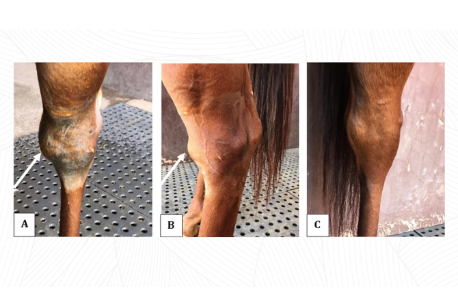 Relato de caso: CONDROMALÁCIA NA ARTICULAÇÃO TÍBIO TÁRSICA