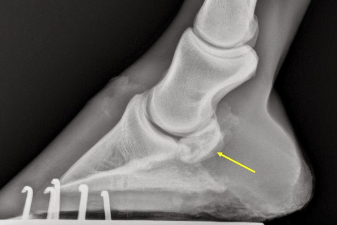Síndrome do Navicular em equinos, quais os sinais clínicos e como tratar?